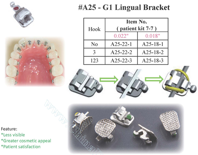 lingual bracket, self-ligating Lingual Bracket