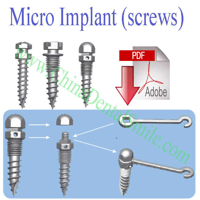 Micro-implant Catalog