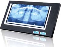 Dental x-ray film viewer